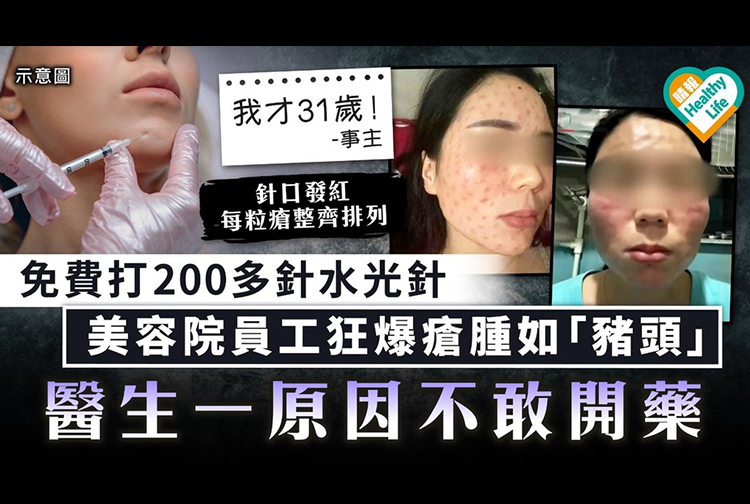 護膚就像做運動那樣，要長久建立的，一時貪快就會有以下效果風險，和要了解自己皮膚膚質是否屬於敏感肌膚