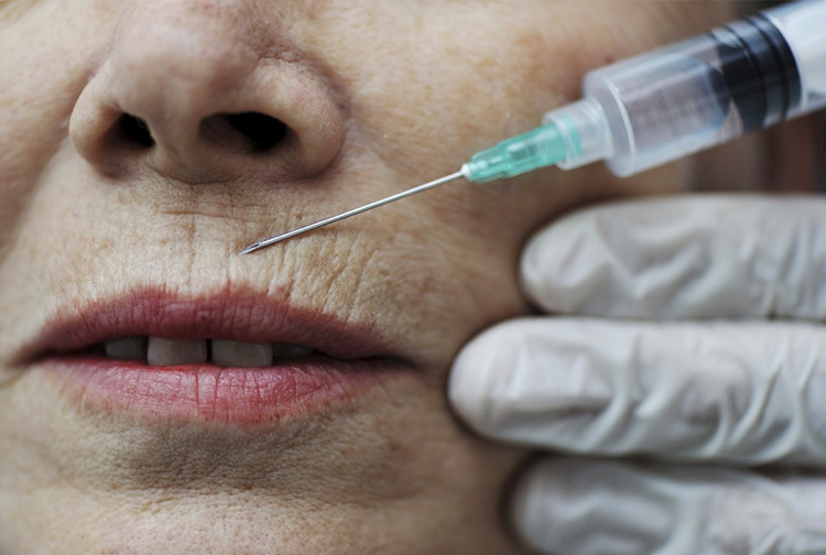 衛生防護中心公布，正調查一宗在韓國首爾注射肉毒桿菌毒素後出現肉毒中毒的疑似個案，涉及一名25歲女病人。